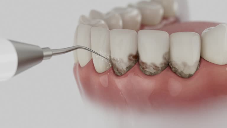 Trusted Emergency Dentist service in Centralia, IL - Dentist Open Now